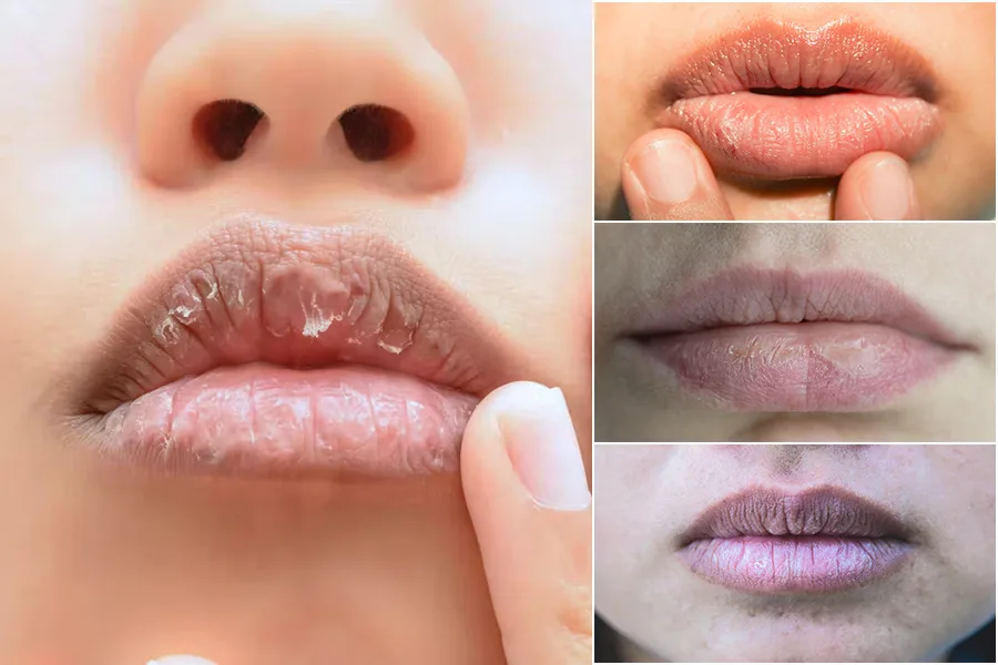 Keep your Lips Moisturized