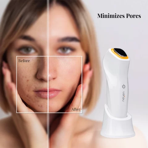 HOT & COOL SKIN FIT- 4 level Temperature Facial Treatment Tool for Skincare