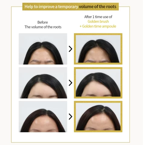 TIME MACHINE GOLDEN BRUSH – Scalpcare device for hair growth and hair fall treatment