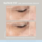 NuFACE FIX Line Smoothing Device