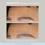 NuFACE FIX Line Smoothing Device