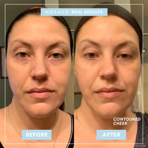NuFACE mini Facial Toning Device (includes Gel Primer)