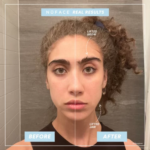 NuFACE Trinity Facial Toning Device With Ele & Twr Attachment and Aqua Gel Activator
