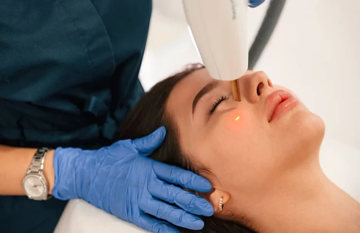 Fractional Laser Treatment Top 7 Questions Answered