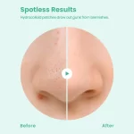 GLAM UP Spotless Nose Patch Hydrocolloid