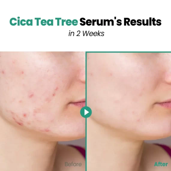 GLAM UP Clear Soothing Cica Tea Tree Serum