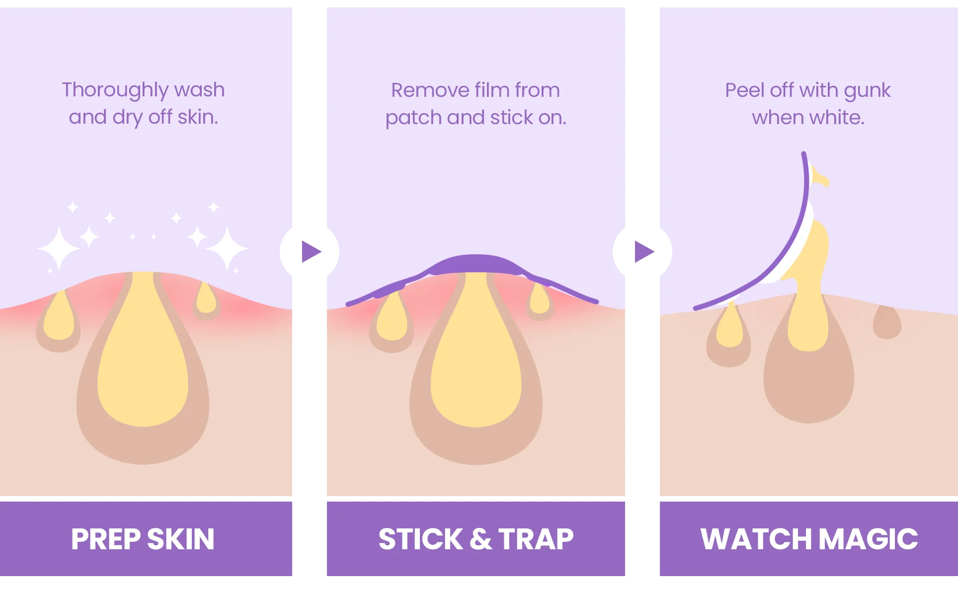 Spotless Hydrocolloid Pimple Patch XL Band