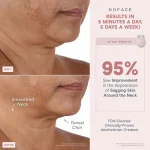 NuFACE MINI+ Smart Advanced Facial Toning Device (Velvet Rose)