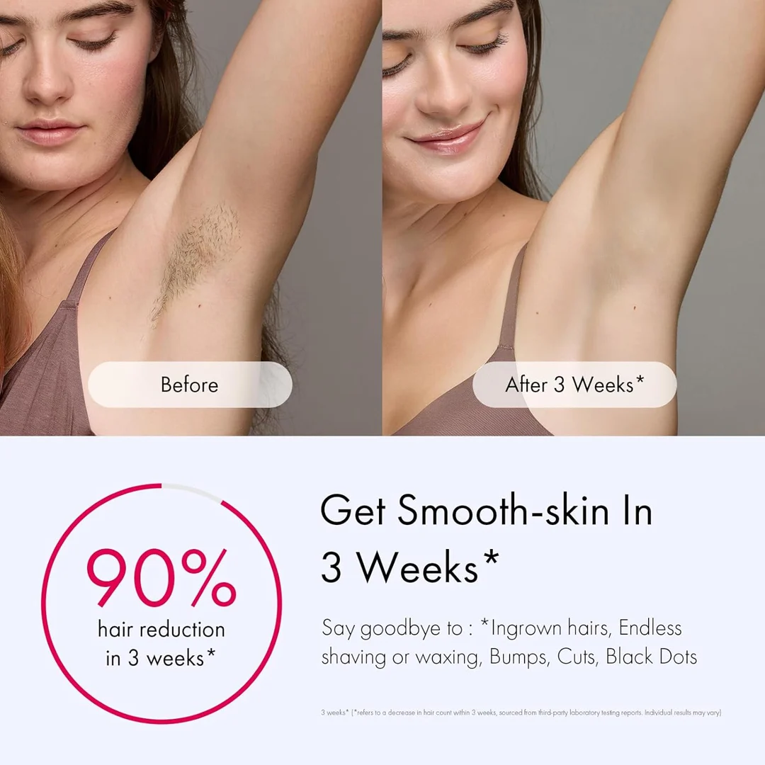 ULIKE Laser Hair Removal  Air 3-Purple