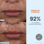 NuFACE FIX MicroWand
