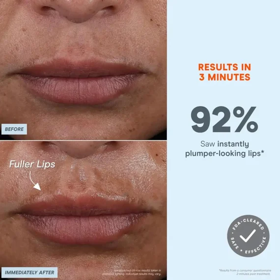 NuFACE FIX MicroWand