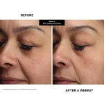 KATE SOMERVILLE  MEGA-A Skin Transforming Serum