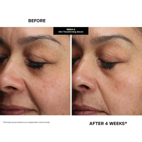 KATE SOMERVILLE  MEGA-A Skin Transforming Serum