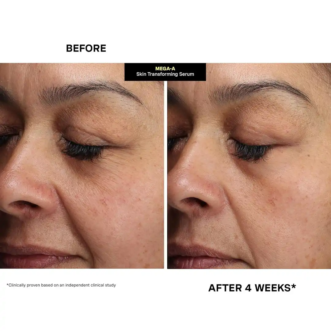 KATE SOMERVILLE MEGA-A Skin Transforming Serum