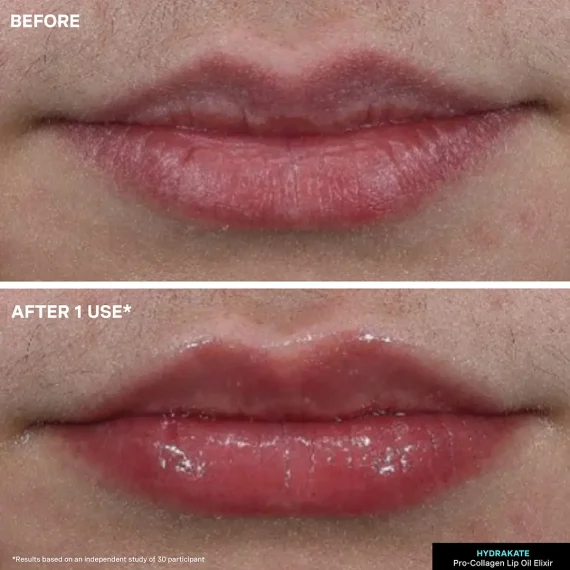 KATE SOMERVILLE Pro-Collagen Lip Oil Elixir