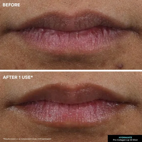 KATE SOMERVILLE Pro-Collagen Lip Oil Elixir