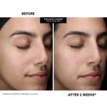 KATE SOMERVILLE Pore-fect Holiday Trio