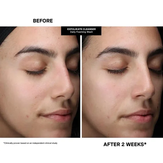 KATE SOMERVILLE Pore-fect Holiday Trio