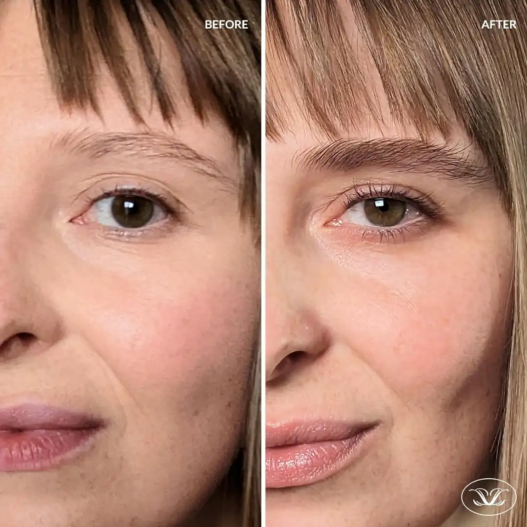 LILASH BEAUTY Eye Brow XL 6ml