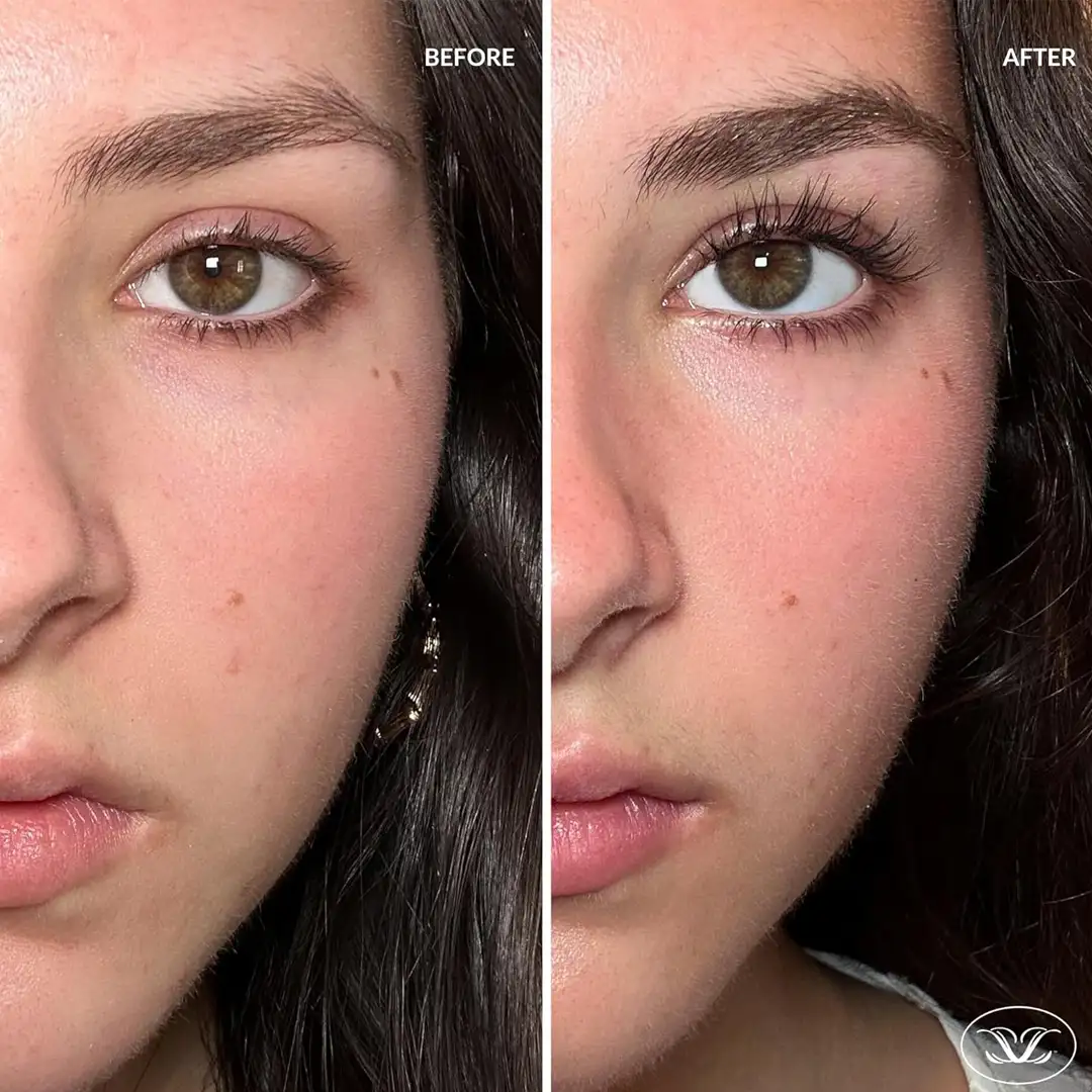 LILASH BEAUTY Eye Lash Serum 4ml