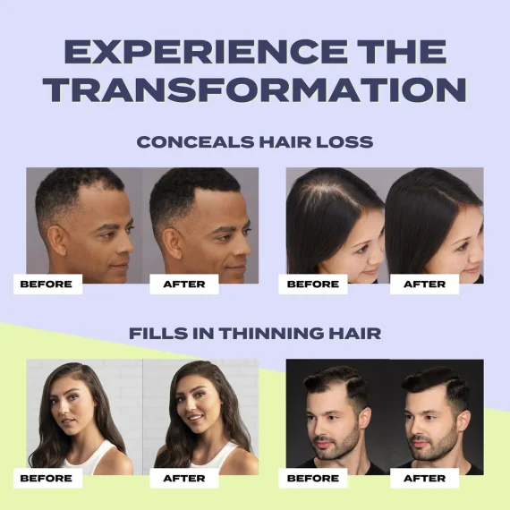 TOPPIK Hair Building Fibers Black 12g