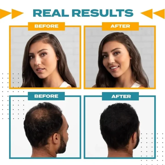 TOPPIK Fiber Hold Spray 118ml