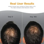 VIVISCAL Man Supplements 180 Tabs