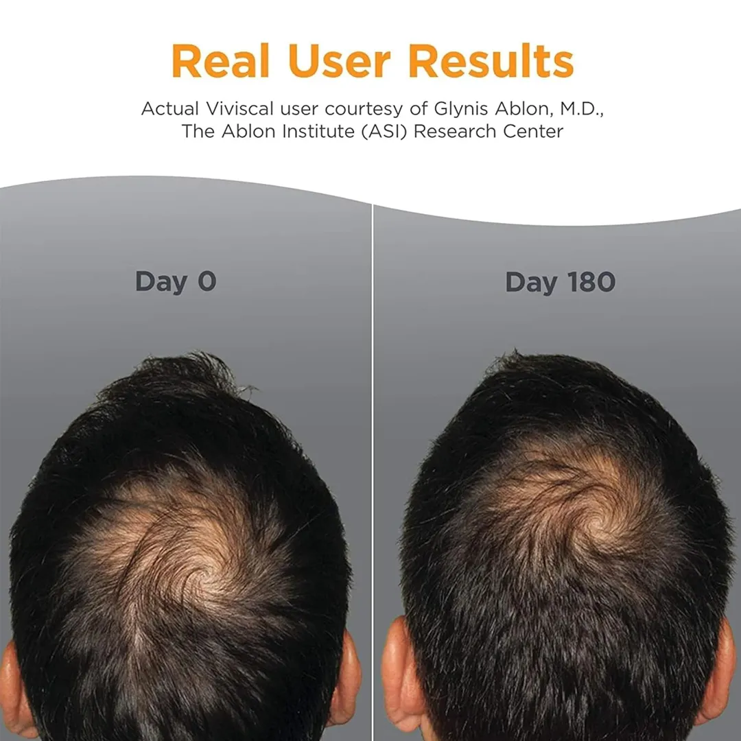 VIVISCAL Man Supplements 180 Tabs