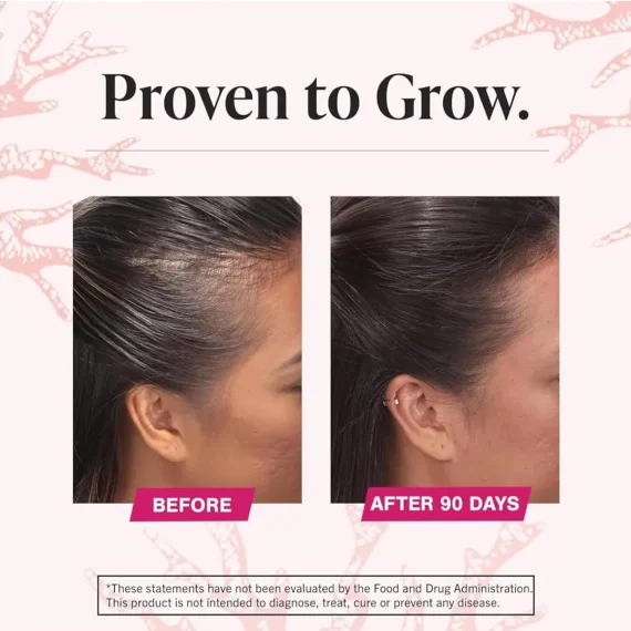 VIVISCAL Max Strength Supplements 180 Tabs Women