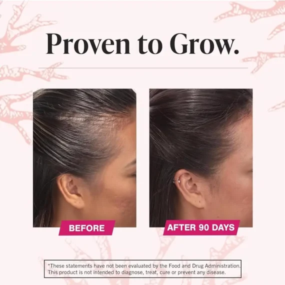 VIVISCAL Max Strength Supplements 60 Tabs Women