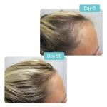 VIVISCAL Professional 180 Tabs