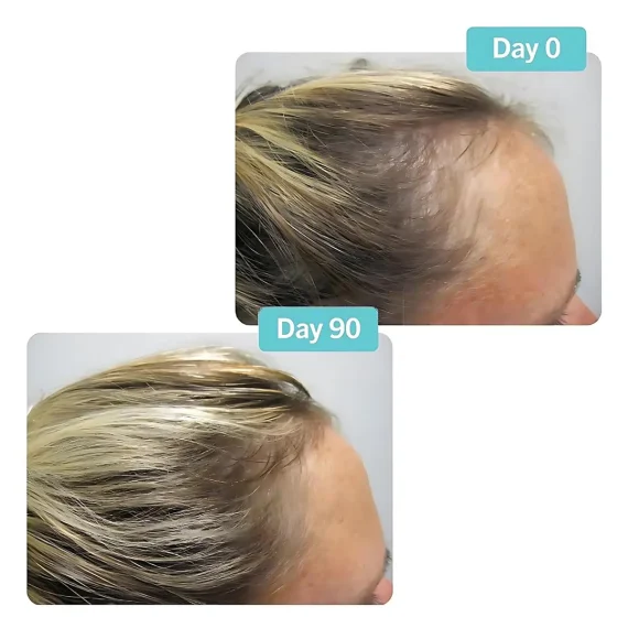 VIVISCAL Professional 180 Tabs