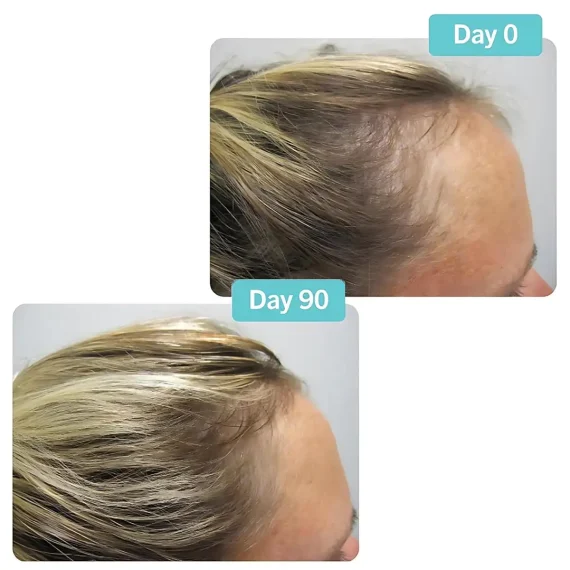 VIVISCAL Professional 60 Tabs