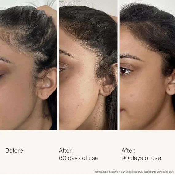 LIVING PROOF Scalp Care Density Serum 50ml