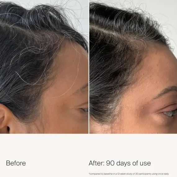 LIVING PROOF Scalp Care Density Serum 50ml