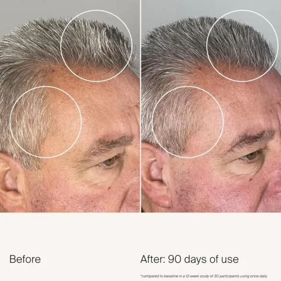 LIVING PROOF Scalp Care Density Serum 50ml