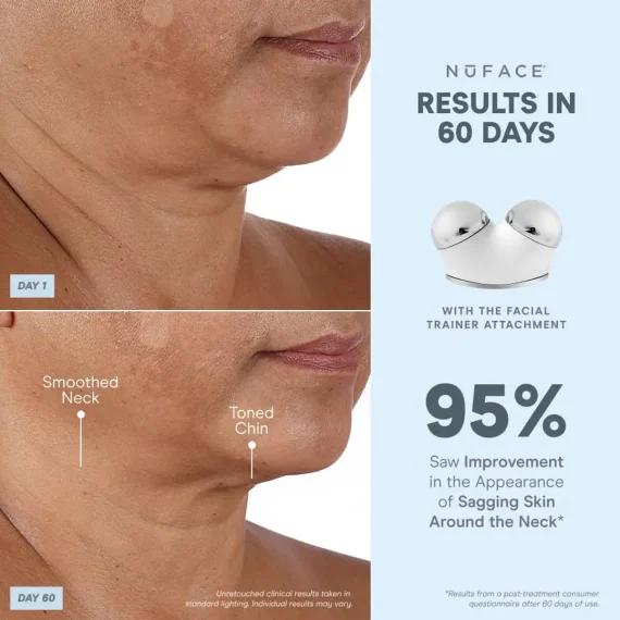 NuFACE TRINITY+ Starter Kit