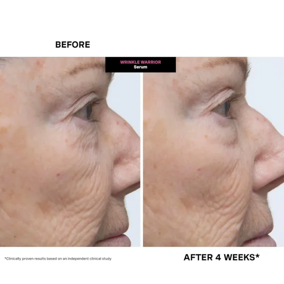 KATE SOMERVILLE Wrinkle Warrior 2-in-1 Plumping Moisturizer + Serum - 50 ml