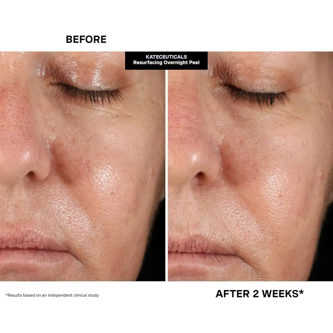 KATE SOMERVILLE KateCeuticals Resurfacing Overnight Peel - 30 ml