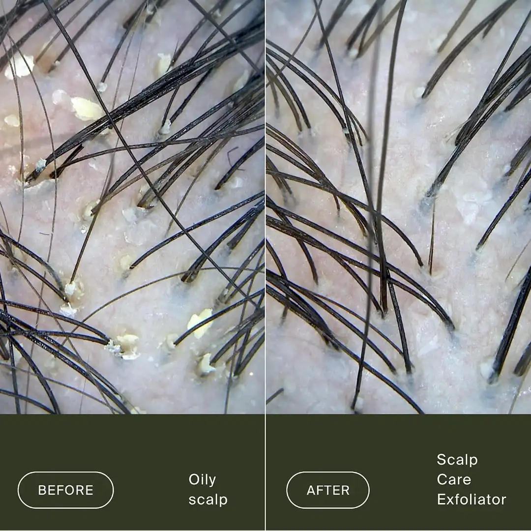 Living Proof Scalp Exfoliator