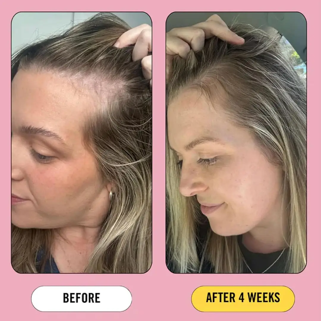 Growth Bomb Post Pregnancy Serum 80ml